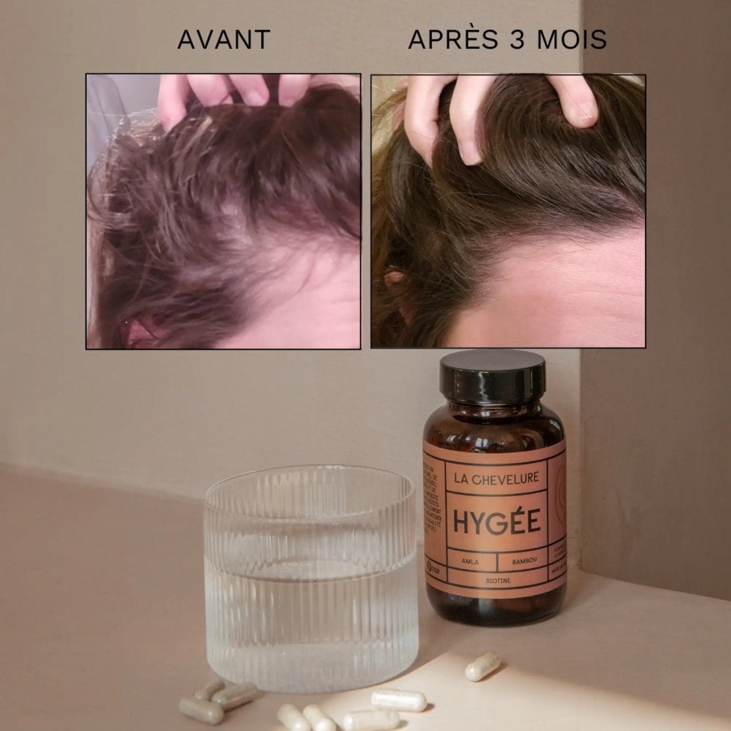 La Chevelure - Hygée - Compléments alimentaires cheveux